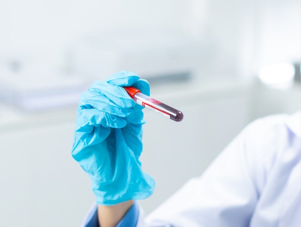Family medicine physician completing pre-operative clearance paperwork for a patient in Davenport, FL